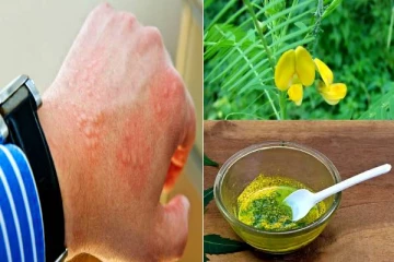 சொறி சிரங்குக்கிற்கு இதை விட்டால் மருந்தே இல்லை! எங்கு இருக்கு தெரியுமா?