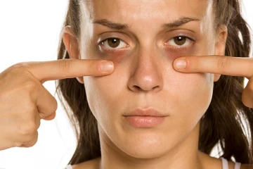 எப்பேர்ப்பட்ட கருவளையத்தையும் போக்க வேண்டுமா? இதோ சூப்பரான டிப்ஸ்!