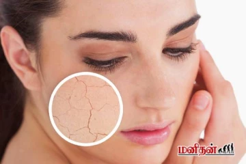 சரும வறட்ச்சிக்கு இன்றே முற்றுப்புள்ளி - இந்த பொருட்கள் போதும்