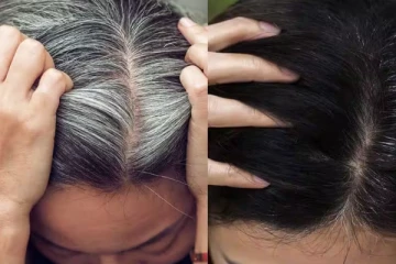 7 நாட்களில் நரை முடியை கருப்பாக்கலாம்; ரொம்ப சிம்பிள் - இதை மட்டும் பண்ணுங்க..