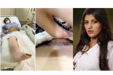 மருத்துவமனையில் வயிற்றில் தையல் காயங்களுடன் நடிகை யாஷிகா - வீடியோ வைரல்!