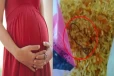 அரசின் சத்துணவு திட்டம் - கர்ப்பிணிக்கு வழங்கப்பட்ட உணவில் இருந்த பாம்பு