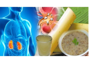 சிறுநீரகக் கற்களை அடியோடு வெளியேற்ற வாழைத்தண்டு சூப்