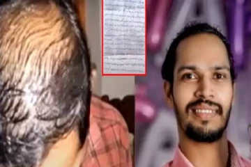 முடி கொட்டியதால் பெண் கிடைக்கவில்லை : இளைஞர் தூக்கிட்டு தற்கொலை