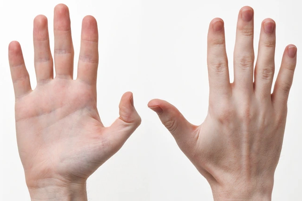 கைகளை வைத்தே உங்க ஆரோக்கியத்தை தெரிஞ்சிக்கலாம்... எப்படினு தெரியுமா? | Your Hand Says Your Health Condition கைகளை வைத்தே உங்க ஆரோக்கியத்தை தெரிஞ்சிக்கலாம்... எப்படினு தெரியுமா? | Your Hand Says Your Health Condition