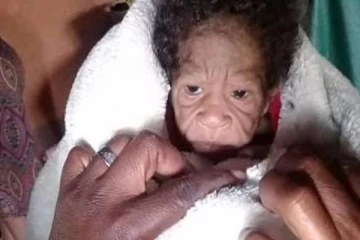 பிறந்த குழந்தையின் முகத்தை பார்த்து அதிர்ச்சியில் உறைந்த தாய்... காரணம் என்ன? நெஞ்சை உருக்கும் சம்பவம்!