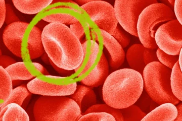 உடலிலுள்ள ஹீமோகுளோபின் அதிகரிக்க வேண்டுமா? இதோ 10 வழிகள்