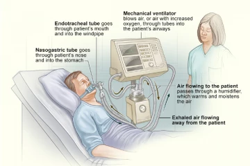 உயிர் காக்கும் கருவியின் சத்தம் தொந்தரவாக இருந்ததால் நோயாளி செய்த பயங்கர செயல்