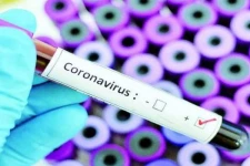 கொரோனாவால் இறக்கும் நபர்களின் உடல்கள் தகனம் மாத்திரமே செய்யப்படும் - சுகாதார அமைச்சு