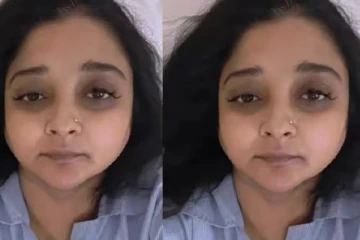 முகம் வீங்கிய நிலையில் பார்க்கவே பரிதாபமாக மாறிய நடிகை: சிகிச்சையிலும் மக்களுக்கு கொடுத்த எச்சரிக்கை!