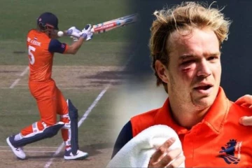 பேட்ஸ்மேன் முகத்தை பதம் பார்த்த பாகிஸ்தான் வீரரின் வேகப்பந்து: வீடியோ காட்சி