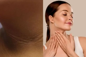 கழுத்தில் உள்ள கருமை இரண்டே வாரத்தில் நீங்க சூப்பர் டிப்ஸ்