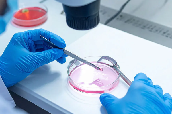 197 குழந்தைகளை அபாயத்தில் தள்ளிய விந்தணு தானமளிப்பவர் | Sperm Donor Who Put 197 Children At Risk Cancer 197 குழந்தைகளை அபாயத்தில் தள்ளிய விந்தணு தானமளிப்பவர் | Sperm Donor Who Put 197 Children At Risk Cancer