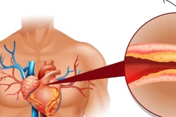 உங்கள் கொலஸ்ட்ரால் அளவை கட்டுக்குள் வைத்திருக்க இந்த உணவுகள் போதும்!