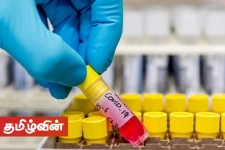 பாடசாலை வளாகத்தில் மயங்கி விழுந்த மாணவிக்கு கொரோனா தொற்று