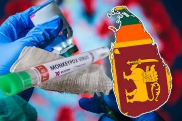 குரங்கம்மை நோய் தொடர்பில் சுகாதார அமைச்சு வெளியிட்டுள்ள அறிவிப்பு