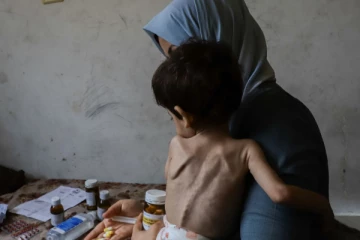 காசாவில் தற்போது கடும் பஞ்சம்; மக்கள் உயிரிழக்கும் அபாயம்