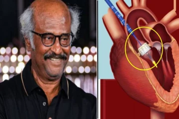 Transcatheter முறையில் நடந்த சிகிச்சை- ரஜினிகாந்த அறிக்கையில் சிக்கிய தகவல்