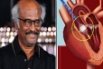 Transcatheter முறையில் நடந்த சிகிச்சை- ரஜினிகாந்த அறிக்கையில் சிக்கிய தகவல்