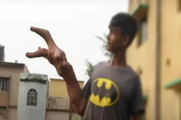 கை மட்டுமே 8 கிலோ... அரிய வகை நோயால் பாதிக்கப்பட்ட சிறுவன்: பிசாசின் குழந்தை என ஒதுக்கிய மக்கள்