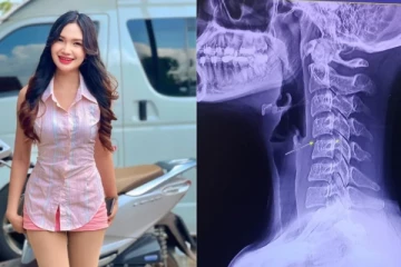 மசாஜின் போது கழுத்தை முறுக்கியதால் விபரீதம் - 20 வயது பாடகி உயிரிழப்பு