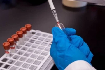 வவுனியாவில் ஆடைத் தொழிற்சாலை பணியாளர்கள் உட்பட 8 பேருக்கு கோவிட்