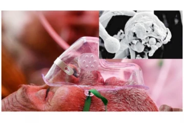 தமிழகத்தில் ஒரே நாளில் கருப்பு பூஞ்சை நோய்க்கு 3 பேர் பலி!