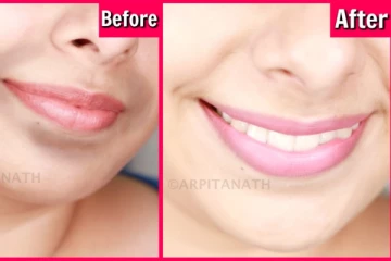 வாயை சுத்தி அசிங்கமா கருப்பா இருக்கா? இதை போக்க இதோ சில டிப்ஸ்