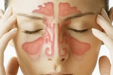 சைனஸ் பிரச்சனையால் அவதிப்படுறீங்களா? இதனை எப்படி எளியமுறையில் போக்கலாம்?