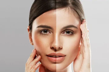 சருமத்தின் நிறத்தை இயற்கைமுறையில் அதிகரிக்க வேண்டுமா? இதோ சில குறிப்புகள் !!