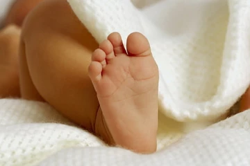 வாலுடன் பிறந்த அதிசய குழந்தை