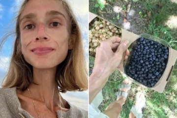 பழங்களை மட்டும் சாப்பிடும் உணவு முறை: விபரீதமான டயட் முறையால் 27 வயது பெண் உயிரிழப்பு