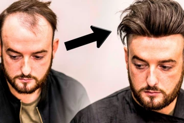 தலைமுடியை வளர வைக்கும் 5 அற்புத உணவுகள்: தினமும் சாப்பிடுங்க