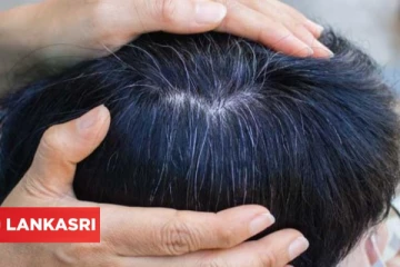 சிறு வயதிலே இளநரையா? இதனை எப்படி தடுக்கலாம்?