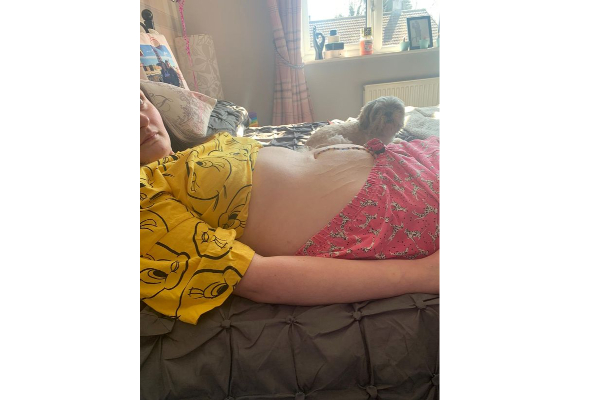 9 மாத கர்ப்பிணியாக கருதப்பட்ட இளம் பெண் வயிற்றிலிருந்து 13 அங்குல நீர்க்கட்டி அகற்றப்பட்டது! | World Viral News