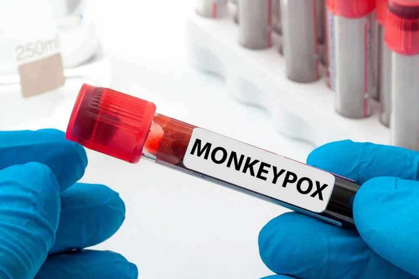 கனடாவில் அதிகரித்துவரும்  குரங்கம்மை தொற்று | An Increasing Incidence Of Monkeypox In Canada