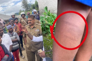 பாடசாலை அதிபரால் தாக்கப்பட்ட மாணவர்கள் வைத்தியசாலையில் அனுமதி