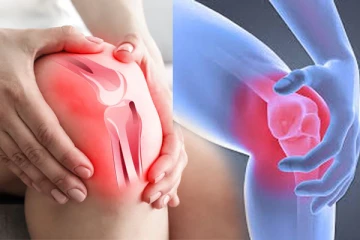 அடிக்கடி உங்களுக்கு மூட்டு வலியா? இனி இந்த உணவுகள் வேண்டாம்!