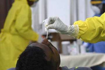 யாழ்ப்பாணத்தில் வெளியான கோவிட் பரிசோதனை முடிவுகளால் சர்ச்சை