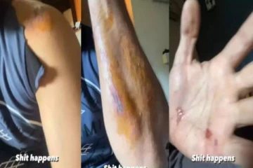 விபத்தில் சிக்கிய விஜய் டிவி சீரியல் நாயகன்- இப்போது எப்படி உள்ளார் தெரியுமா?