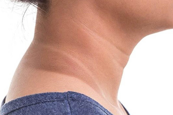 உங்கள் கழுத்து கருமையாக இருக்கா? அதற்கு காரணம் இவைதானாம்! | Is Your Neck Dark These Are The Reasons For That உங்கள் கழுத்து கருமையாக இருக்கா? அதற்கு காரணம் இவைதானாம்! | Is Your Neck Dark These Are The Reasons For That