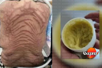 දෙයියනේ ඔන්ලයින් ගෙන්වපු ක්‍රීම් එක ගාපු තරුණියගෙ ඇඟ සර්ප හමක් වෙලා - ඔයත් මේ වගේ ක්‍රීම් එකක් ගෑවද