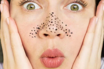 மூக்கு ஓரங்களில் வரும் கருமையை அடையாளம் தெரியாமல் விரட்டியடிக்க இதை தடவுங்க