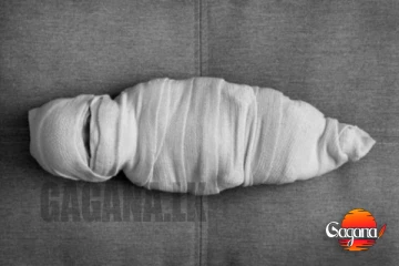 මල් කැකුළ මරාගත්තා.. මෙහෙමත් වෛද්‍යවරු මාස 14 සිගිත්තට ප්‍රතිකාර කරන්න බෑ කියලා