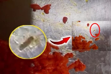 யாழில் பிரபல உணவகமொன்றில் வழங்கப்பட்ட உணவில் புழுக்கள்