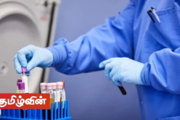 வவுனியாவில் ஆடைத்தொழிற்சாலையில் மேலும் ஐந்து பேருக்கு கோவிட் தொற்று உறுதி