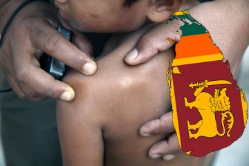 சிறுவர் தொழுநோயார்கள் அதிகளவில் பதிவாகும் நாடுகளில் இலங்கை 5 ஆவது இடம்