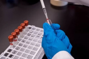 மண்முனை மேற்கு பகுதியில் அன்டிஜன் பரிசோதனை முன்னெடுப்பு