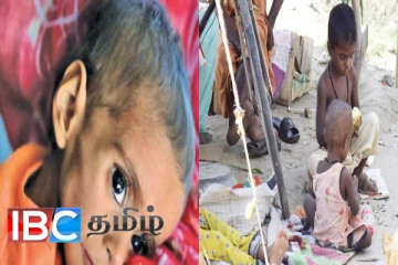 கடும் உணவுப்பற்றாக்குறை : பாகிஸ்தானில் பேராபத்தில் குழந்தைகள்