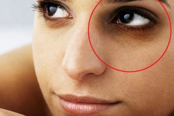 ஒரே வாரத்தில் நிரந்தரமாக கருவளையத்தை போக்க உதவும் எளிய வீட்டு வைத்தியம்